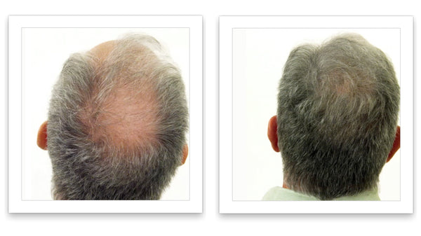 Caboki Hair Fiber, Trial Size