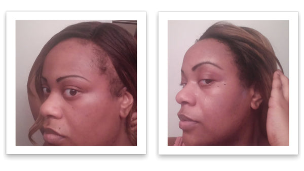 Caboki 10X Hair Powder - Enhances Hairline, Hair Volume, Root Touch Up. Talc-Free, Mica-Free.