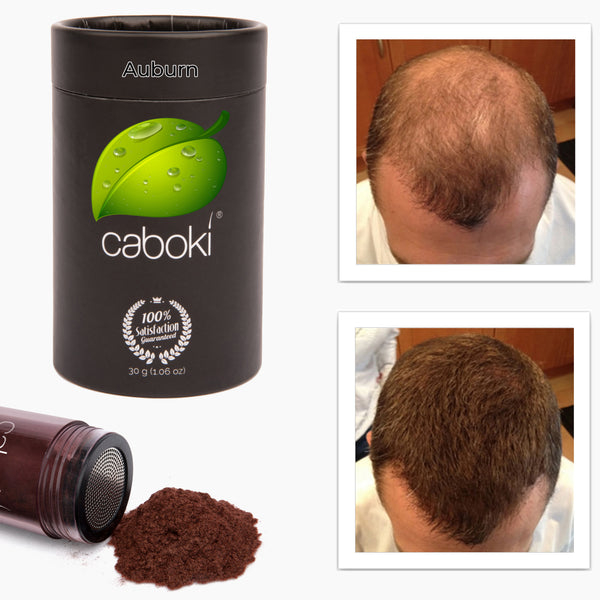 Caboki Hair Fiber, All-Natural Hair Loss Concealer (30 Gram, 90-day supply)
