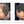 Before and after image of a man with short curly black hair that is thinning on the front and has a bald spot on his crown