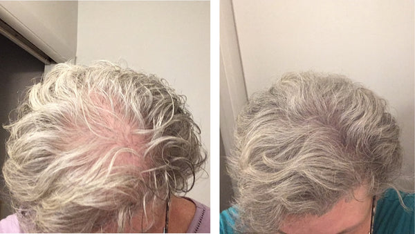 Before and after image of a person with short wavy gray hair and a bald spot on their crown
