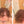 Before and after image of a person with short curly reddish-brown hair with thin hair on the crown