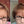 Before and after image of a person with short brown hair and a bald spot on their crown