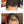 Before and after image of a man with short curly black hair with a bald spot on the crown and front scalp