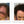 Before and after image of a woman with straight dark brown hair with a bald spot that extends from the frontal scalp to the crown